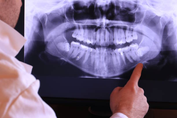 Best Teeth Whitening  in Brackettville, TX